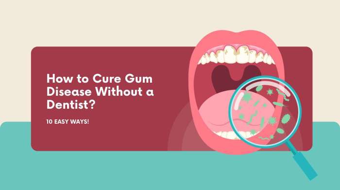 Gum disease cure dentist without signs first prevent treat treatment natural